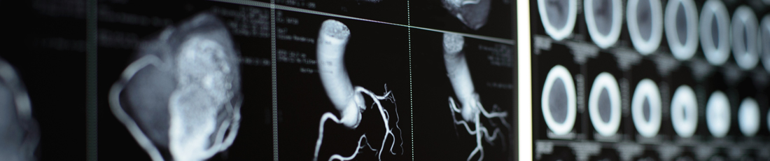 Cardiac MRI